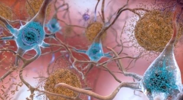 Alzheimer: scoperto enzima come possibile nuovo bersaglio farmacologico