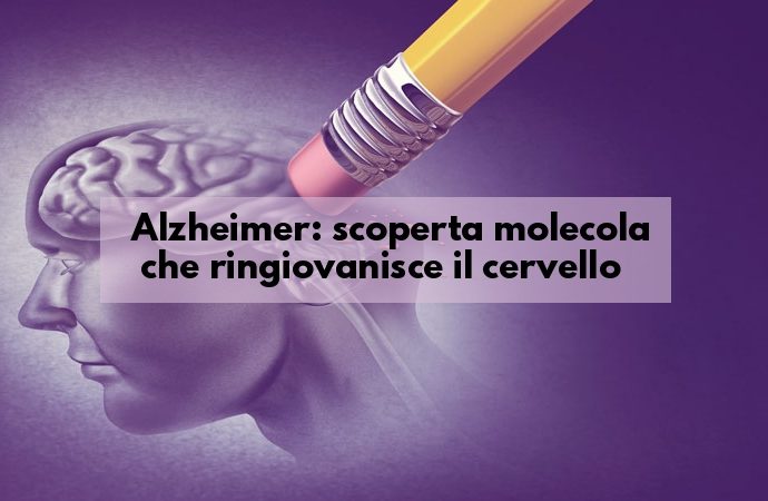 Alzheimer nuove scoperte