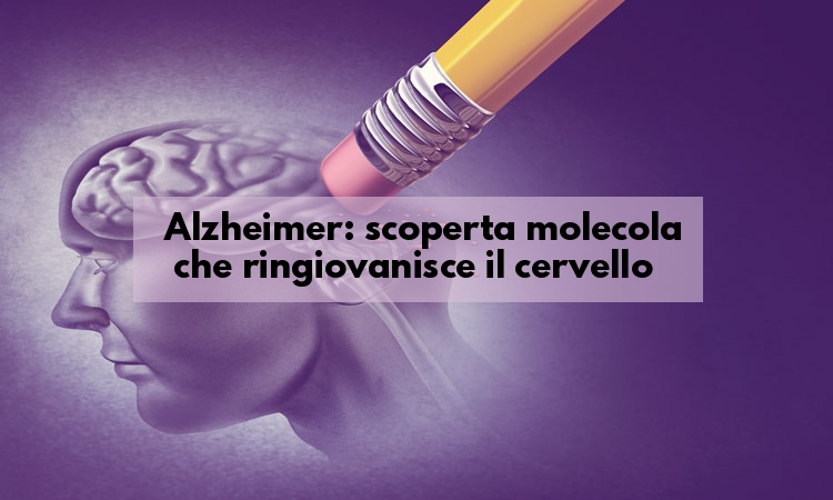 Alzheimer nuove scoperte