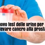 Nuovo test delle urine per cancro prostata: si può fare a casa