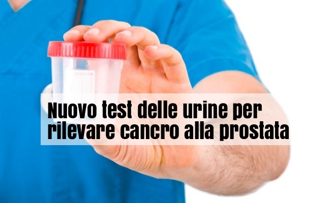 Nuovo test urine per cancro prostata