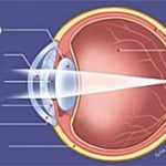 Glaucoma speranze per nuove cure con cellule staminali