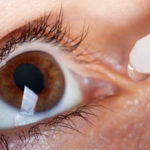 Glaucoma nuove scoperte: vitamina B3 protegge cellule nervose