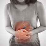 Morbo di Crohn: nuove scoperte sulle cause scatenanti