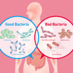 Infiammazione intestinale cura con Lactobacillus acidophilus