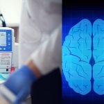 Attività cerebrale post mortem: registrato aumento onde gamma